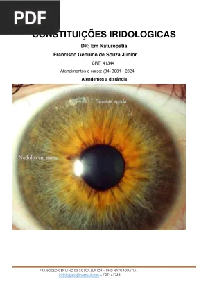 Constituições Iridologicas