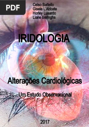 Iridologia - Alterações Cardiológicas