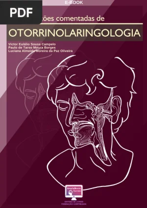 1000 questoes comentadas de Otorrinolaringologia